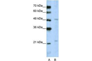Western Blotting (WB) image for anti-WD Repeat Domain 12 (WDR12) antibody (ABIN2462386) (WDR12 antibody)