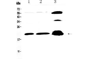 Western blot analysis of CPI17 alpha using anti- CPI17 alpha antibody . (CPI-17 antibody  (AA 30-126))