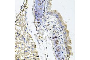 Immunohistochemistry of paraffin-embedded mouse lung using RHOT1 antibody (ABIN5973450) at dilution of 1/100 (40x lens). (RHOT1 antibody)