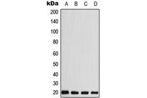 Western blot analysis of CABP5 expression in MDMB435 (A), HEK293T (B), SP2/0 (C), H9C2 (D) whole cell lysates. (CABP5 antibody  (N-Term))