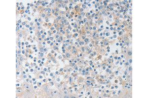 Immunohistochemistry (IHC) image for anti-Neurotrophin 4 (NTF4) antibody (ABIN1873970)