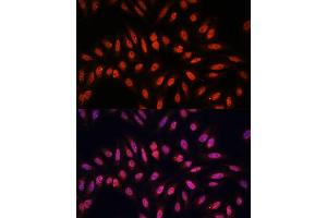 Immunofluorescence analysis of U-2 OS cells using KLHL8 antibody (ABIN7268081) at dilution of 1:100. (KLHL8 antibody  (AA 271-620))