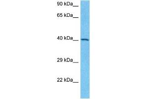 Host:  Rabbit  Target Name:  SNIP1  Sample Type:  Jurkat Whole Cell lysates  Antibody Dilution:  1. (SNIP1 antibody  (C-Term))