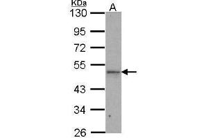 WB Image Sample (30 ug of whole cell lysate) A: H1299 10% SDS PAGE IPMK antibody antibody diluted at 1:1000 (IPMK antibody)