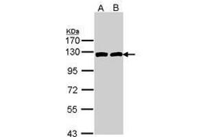 Image no. 1 for anti-ATP Citrate Lyase (ACLY) (AA 793-1008) antibody (ABIN467566) (ACLY antibody  (AA 793-1008))