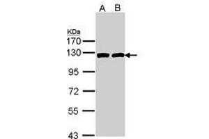 Image no. 1 for anti-ATP Citrate Lyase (ACLY) (AA 793-1008) antibody (ABIN467566)