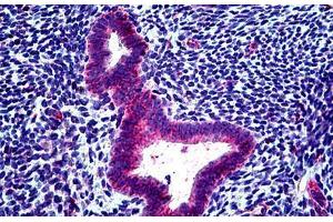 Human Uterus: Formalin-Fixed, Paraffin-Embedded (FFPE) (CLCN2 antibody  (AA 738-751))