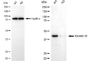 Western blotting analysis using keratin 18 antibody (ABIN7799173).