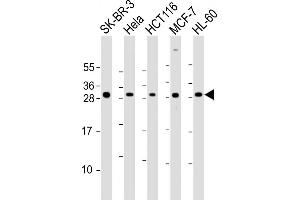 All lanes : Anti-N Antibody (Center) at 1:2000 dilution Lane 1: SK-BR-3 whole cell lysate Lane 2: Hela whole cell lysate Lane 3: HC whole cell lysate Lane 4: MCF-7 whole cell lysate Lane 5: HL-60 whole cell lysate Lysates/proteins at 20 μg per lane. (NAA10 antibody  (AA 135-167))