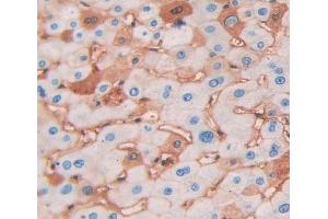 Used in DAB staining on fromalin fixed paraffin- embedded Kidney tissue (NAPA antibody  (AA 1-295))