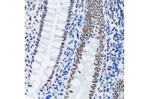 Immunohistochemistry of paraffin-embedded human appendix using PI+PI Rabbit mAb (ABIN7266879) at dilution of 1:100 (40x lens). (E3 SUMO-Protein Ligase PIAS3 (LOC101740849) antibody)