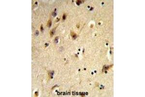 Immunohistochemistry (IHC) image for anti-Histone H2A Type 1-H (HIST1H2AH) antibody (ABIN3003926) (HIST1H2AH antibody)