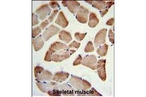 LFNG Antibody (Center) (ABIN653477 and ABIN2842898) IHC analysis in formalin fixed and paraffin embedded skeletal muscle followed by peroxidase conjugation of the secondary antibody and DAB staining. (LFNG antibody  (AA 86-114))