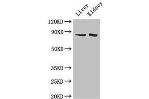 Western Blot Positive WB detected in: Mouse liver tissue, Mouse kidney tissue All lanes: SMO antibody at 2 μg/mL Secondary Goat polyclonal to rabbit IgG at 1/50000 dilution Predicted band size: 87 kDa Observed band size: 87 kDa