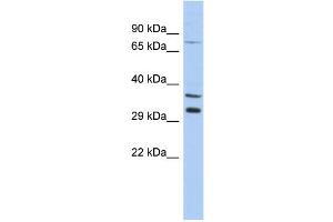 WB Suggested Anti-TSGA13 Antibody Titration: 0. (TSGA13 antibody  (Middle Region))