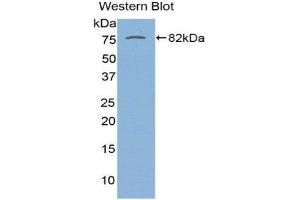 Western Blotting (WB) image for anti-serpin Peptidase Inhibitor, Clade A (Alpha-1 Antiproteinase, Antitrypsin), Member 10 (SERPINA10) (AA 22-448) antibody (ABIN1863312) (SERPINA10 antibody  (AA 22-448))