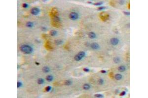 Used in DAB staining on fromalin fixed paraffin-embedded Liver tissue (LAMP2 antibody  (AA 29-192))