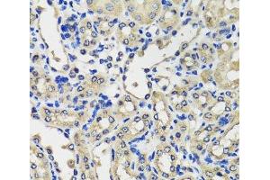 Immunohistochemistry of paraffin-embedded Mouse kidney using SCG3 Polyclonal Antibody at dilution of 1:100 (40x lens).