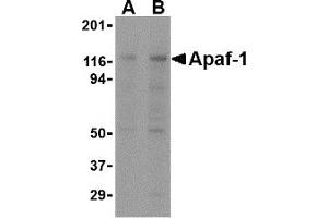 Western Blotting (WB) image for anti-Apoptotic Peptidase Activating Factor 1 (APAF1) antibody (ABIN1031715)