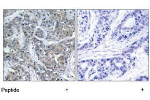 Image no. 1 for anti-Stathmin 1 (STMN1) (Ser15) antibody (ABIN197474) (Stathmin 1 antibody  (Ser15))