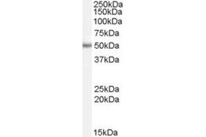 Western Blotting (WB) image for anti-EF-Hand Domain Family, Member B (EFHB) (C-Term) antibody (ABIN2785078) (EFHB antibody  (C-Term))