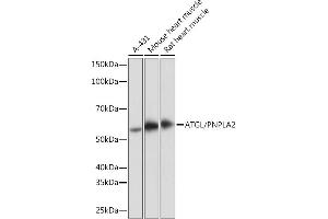 Western blot analysis of extracts of various cell lines, using ATGL/PNPL antibody (ABIN7269183) at 1:1000 dilution. (PNPLA2 antibody)