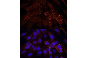 Immunofluorescence analysis of C6 cells using POLRMT antibody (ABIN7269460) at dilution of 1:100. (POLRMT antibody  (AA 42-230))