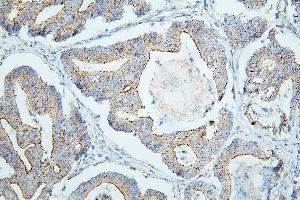 IHC analysis of PDCD6IP using anti-PDCD6IP antibody (ABIN7600490).