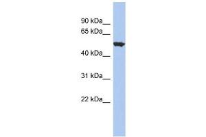 ACCN1 antibody used at 1 ug/ml to detect target protein.