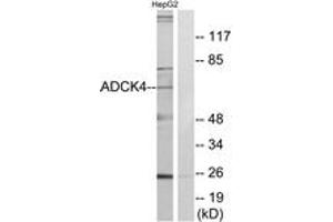 Western Blotting (WB) image for anti-AarF Domain Containing Kinase 4 (ADCK4) (AA 31-80) antibody (ABIN2889721) (ADCK4 antibody  (AA 31-80))