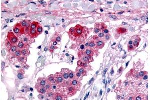 Human Adrenal (formalin-fixed, paraffin-embedded) stained with GPR182 antibody ABIN213455 at 6-9 ug/ml followed by biotinylated goat anti-rabbit IgG secondary antibody ABIN481713, alkaline phosphatase-streptavidin and chromogen. (G Protein-Coupled Receptor 182 antibody  (C-Term))