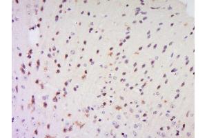 Formalin-fixed and paraffin embedded rat brain labeled with Anti-EXOSC7 Polyclonal Antibody, Unconjugated  at 1:200 followed by conjugation to the secondary antibody and DAB staining. (EXOSC7 antibody  (AA 21-120))