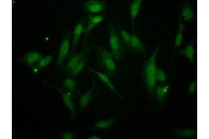 Immunofluorescence staining of Hela cells with ABIN7145800 at 1:266, counter-stained with DAPI.