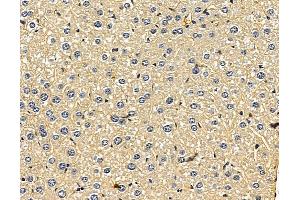 ABIN7096454 and ABIN7100518 at 1/100 staining mouse liver tissue by IHC-P. (UGT2B28 antibody)