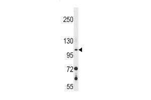 GUCY2F Antibody (C-term) (ABIN1537619 and ABIN2848622) western blot analysis in 293 cell line lysates (35 μg/lane). (GUCY2F antibody  (C-Term))