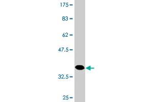Western Blot detection against Immunogen (37. (HAPLN4 antibody  (AA 30-134))