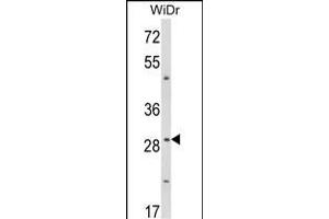 Western blot analysis of ZFP36 Antibody (Center) (ABIN652899 and ABIN2842580) in WiDr cell line lysates (35 μg/lane).