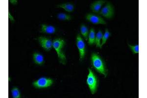 Immunofluorescent analysis of A549 cells using ABIN7172870 at dilution of 1:100 and Alexa Fluor 488-congugated AffiniPure Goat Anti-Rabbit IgG(H+L) (TRPM8 antibody  (AA 1-192))