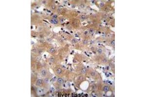 Immunohistochemistry (IHC) image for anti-Transient Receptor Potential Cation Channel, Subfamily M, Member 8 (TRPM8) antibody (ABIN2996363) (TRPM8 antibody)