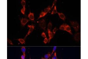Immunofluorescence analysis of NIH/3T3 cells using DVL2 Polyclonal Antibody at dilution of 1:100. (DVL2 antibody)