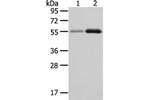 Western Blotting (WB) image for anti-XK, Kell Blood Group Complex Subunit-Related Family, Member 3 (XKR3) antibody (ABIN5962449) (XKR3 antibody)