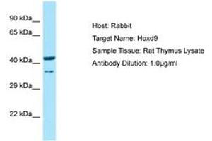 Image no. 1 for anti-Homeobox D9 (HOXD9) (N-Term) antibody (ABIN6749851)