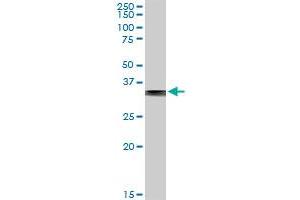 FBP1 MaxPab rabbit polyclonal antibody. (FBP1 antibody  (AA 1-338))