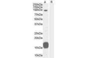 Image no. 1 for anti-rho GTPase Activating Protein 26 (ARHGAP26) (C-Term) antibody (ABIN374371) (GRAF antibody  (C-Term))