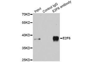 Immunoprecipitation analysis of 200ug extracts of MCF-7 cells using 3ug E2F6 antibody. (E2F6 antibody)