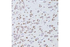 Immunohistochemistry of paraffin-embedded mouse brain using TNFRSF11A antibody.