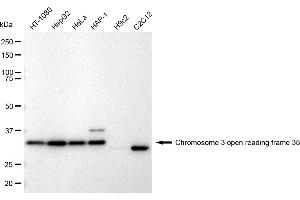 Western blotting analysis using Chromosome 3 open reading frame 38 antibody (ABIN7798079). (Recombinant C3orf38 antibody)