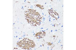 Immunohistochemistry of paraffin-embedded rat brain using APP Rabbit mAb (ABIN7265575) at dilution of 1:100 (40x lens).
