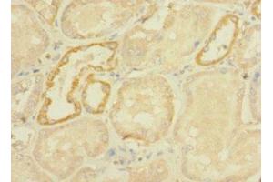 Immunohistochemistry of paraffin-embedded human kidney tissue using ABIN7166755 at dilution of 1:100 (DHX32 antibody  (AA 301-500))