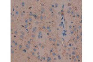 Used in DAB staining on fromalin fixed paraffin- embedded brain tissue (DLG5 antibody  (AA 1724-1917))